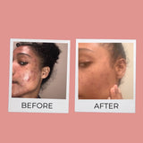 Bye-Bye Dark Spot Duo